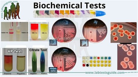 biochemical tests are used to determine.